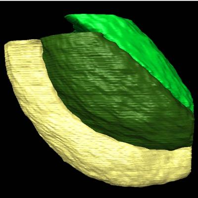 X-ray Image of a Seed