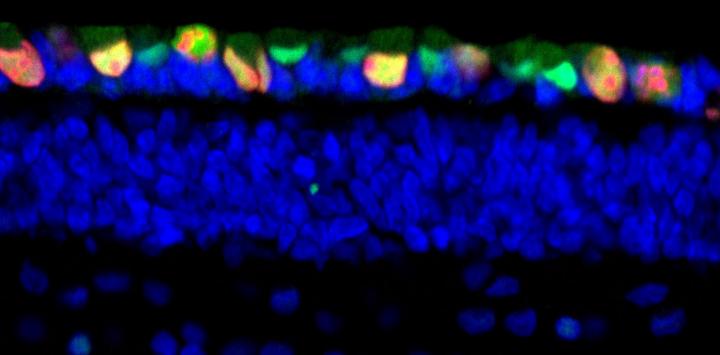 Developing Retina