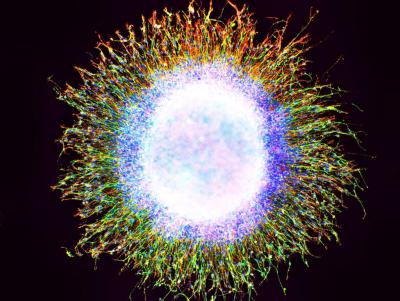 Neural Progenitor Cells in Migration Assay (2 of 2)