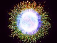 Neural Progenitor Cells in Migration Assay (2 of 2)