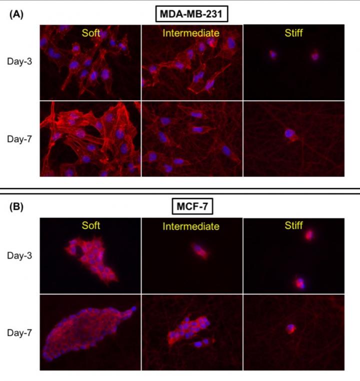Breast Cancer Cells