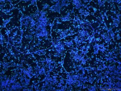 Microbes on Plastic
