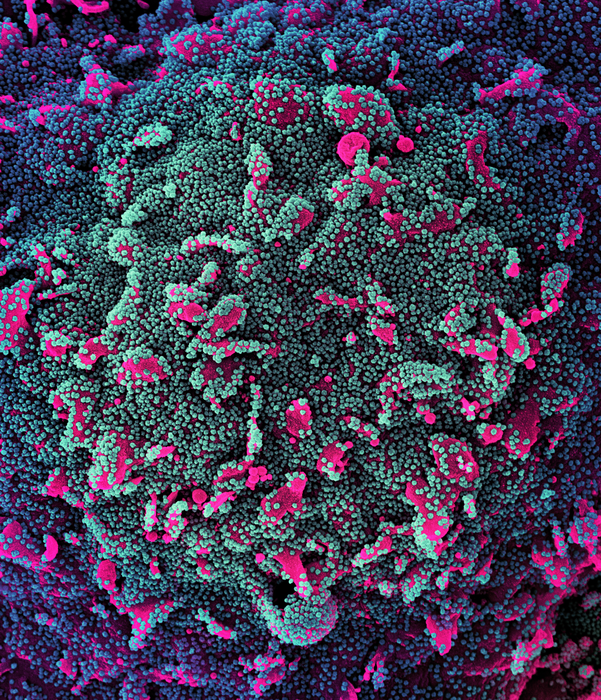 SARS-CoV-2 infection of a human cell