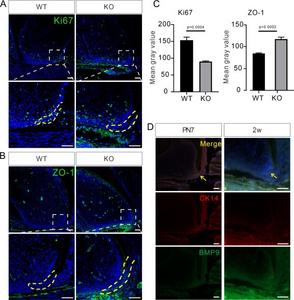 Ablation of Bmp9 reduces cell proliferation and enhances intercellular junctions in HERS.