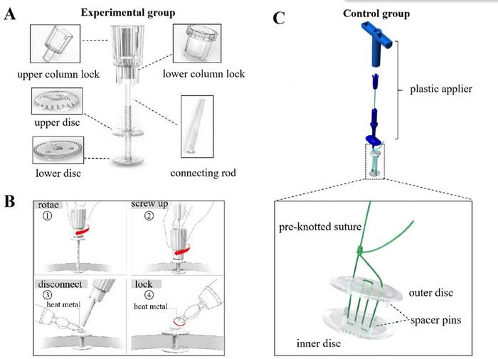 Fully Absorbable Cranial Clamp Speeds Skull Healing