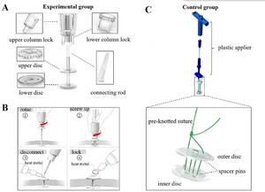 Fully Absorbable Cranial Clamp Speeds Skull Healing
