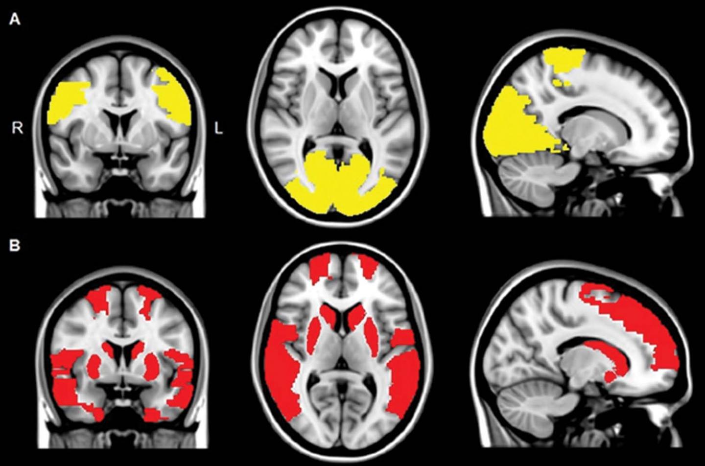 Figure 2 MR Images