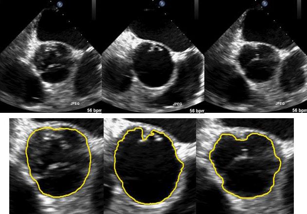 Ultrasound Image