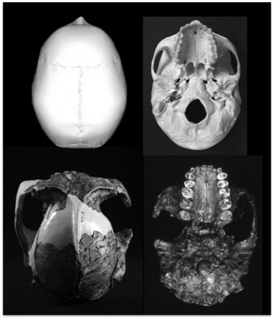 Craniums