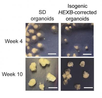 Sandhoff Study Shows Developmental Dysregulation