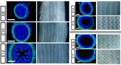 Villi Form Patterns within the Gut during Development