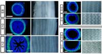 Villi Form Patterns within the Gut during Development