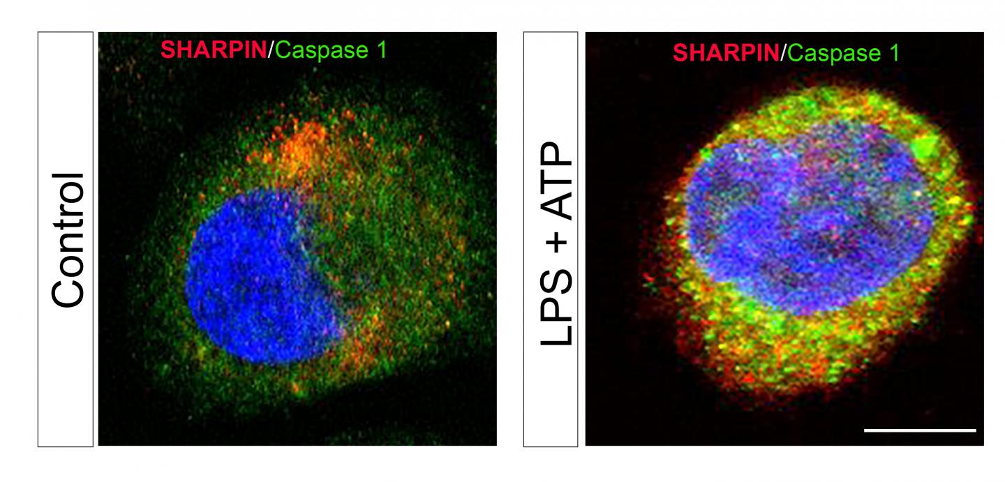 Novel Research Lays the Groundwork for New Therapies Against Sepsis