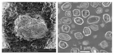 <I>Bacillus anthracis</i>