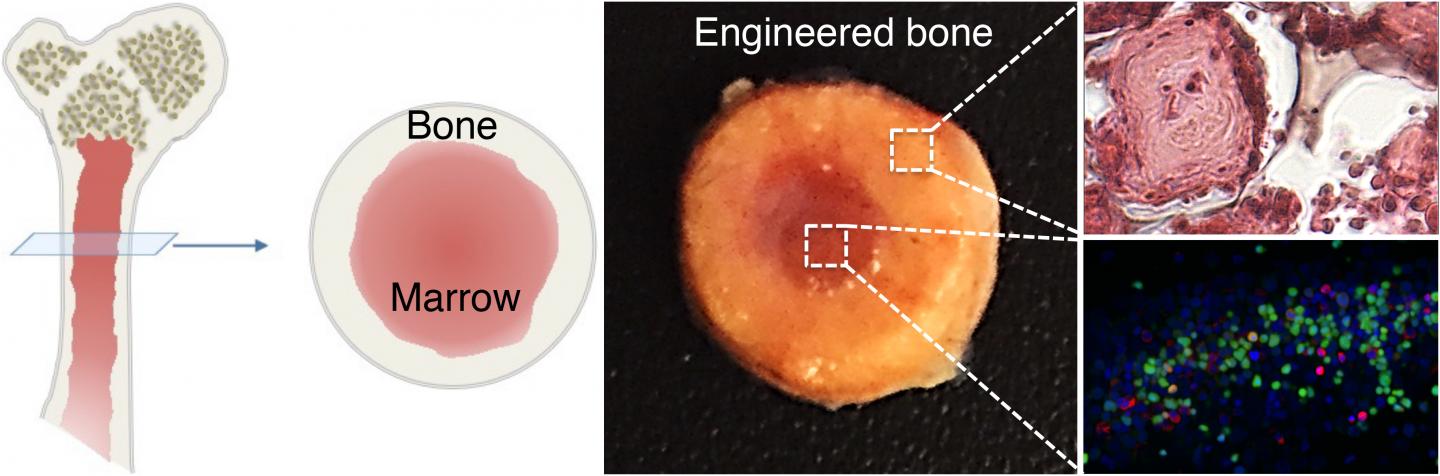 Bone Marrow Illustration