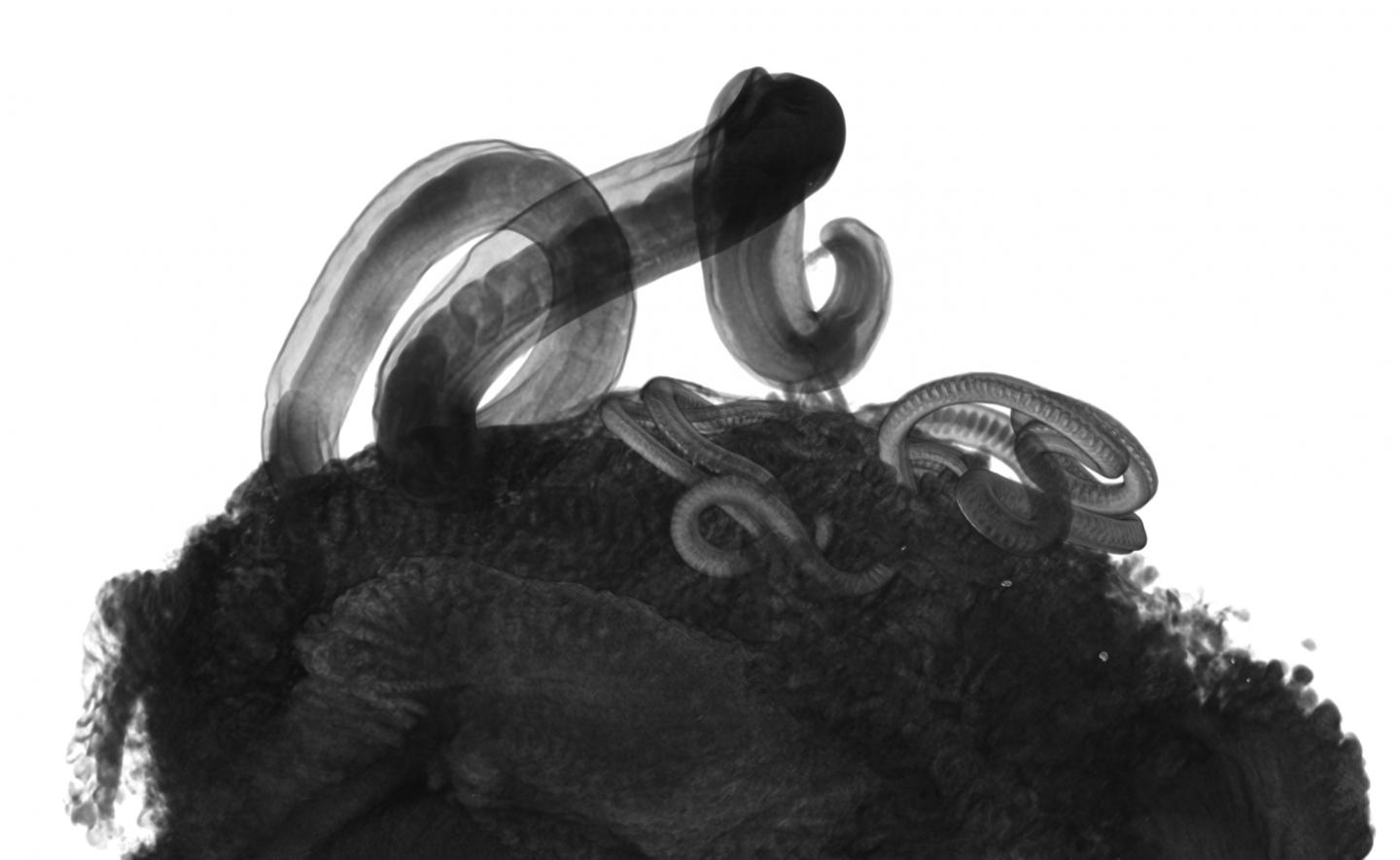 Whipworm