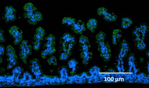 Epithelial Cells 