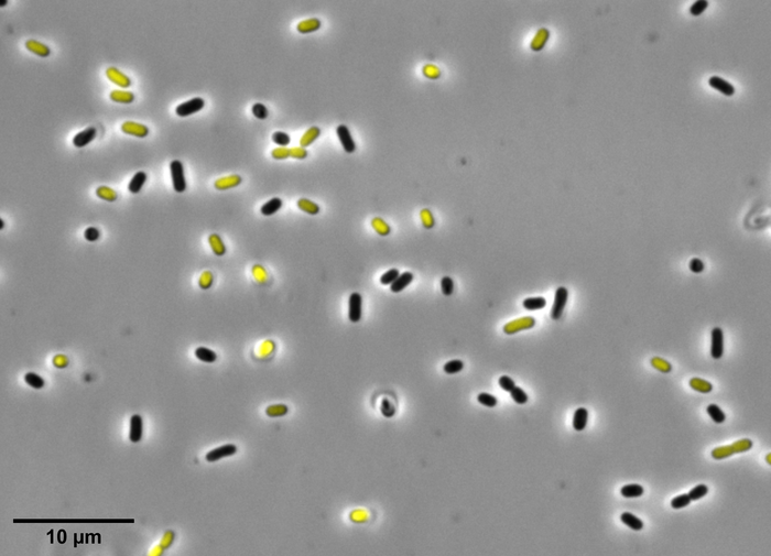 Picture of acid buildup in cells