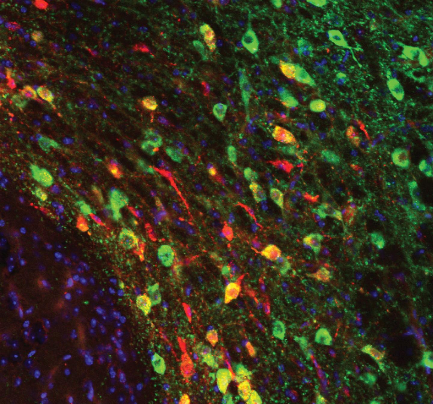 Dopamine Neurons
