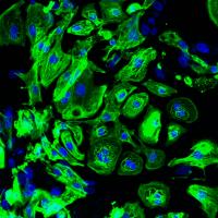 Cardiomyocytes 