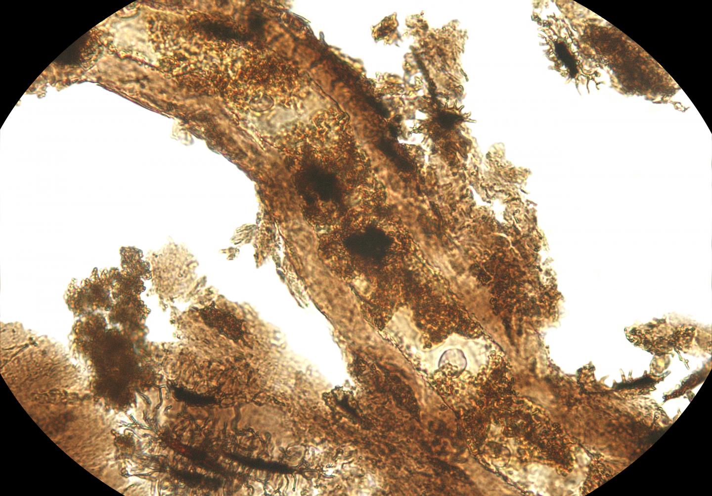Through the Microscope