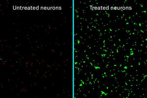 Treated v. untreated human neurons