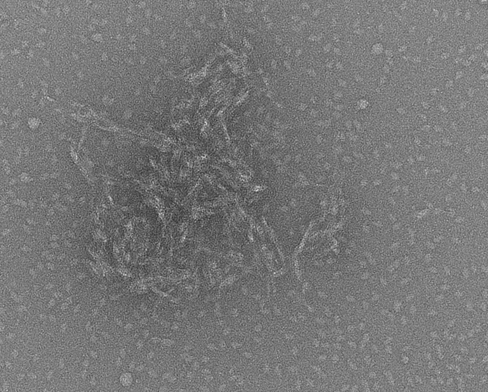 Electron microscope image of protein clusters