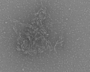 Electron microscope image of protein clusters