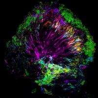 A Plaque Microbiome Community