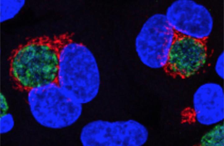 Chlamydia Infecting Human Cells