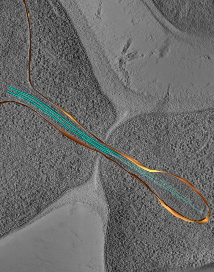 DNA Bridges (2 of 2)