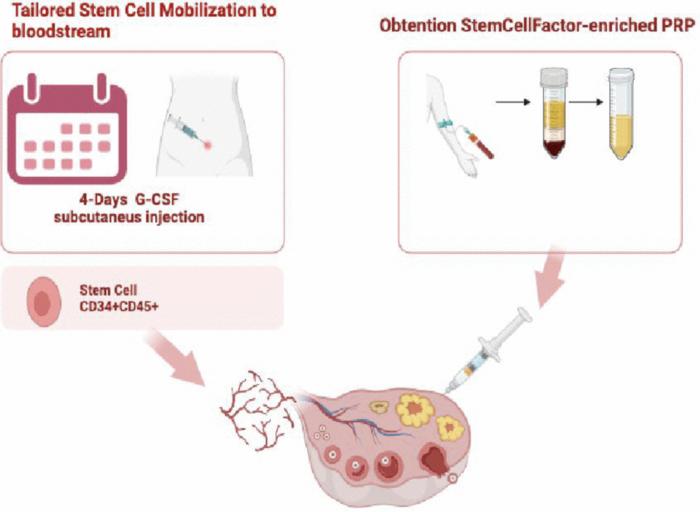 Enhancing oocyte activation in women with ovarian failure: clinical outcomes of the Stem Cell Regenera study using G-CSF mobilization of peripheral blood stem cells and intraovarian injection of stem cell factor-enriched platelet rich plasma in real-world