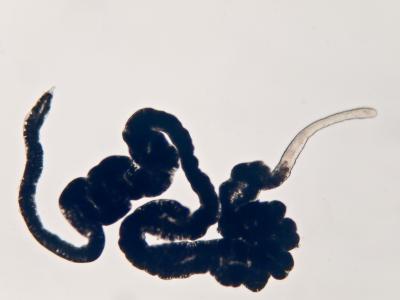 <I>Paracatenula urania</I>