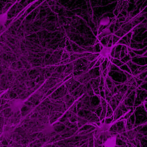 Brain wiring map