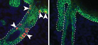 Merkel Cell Development in Mouse Skin