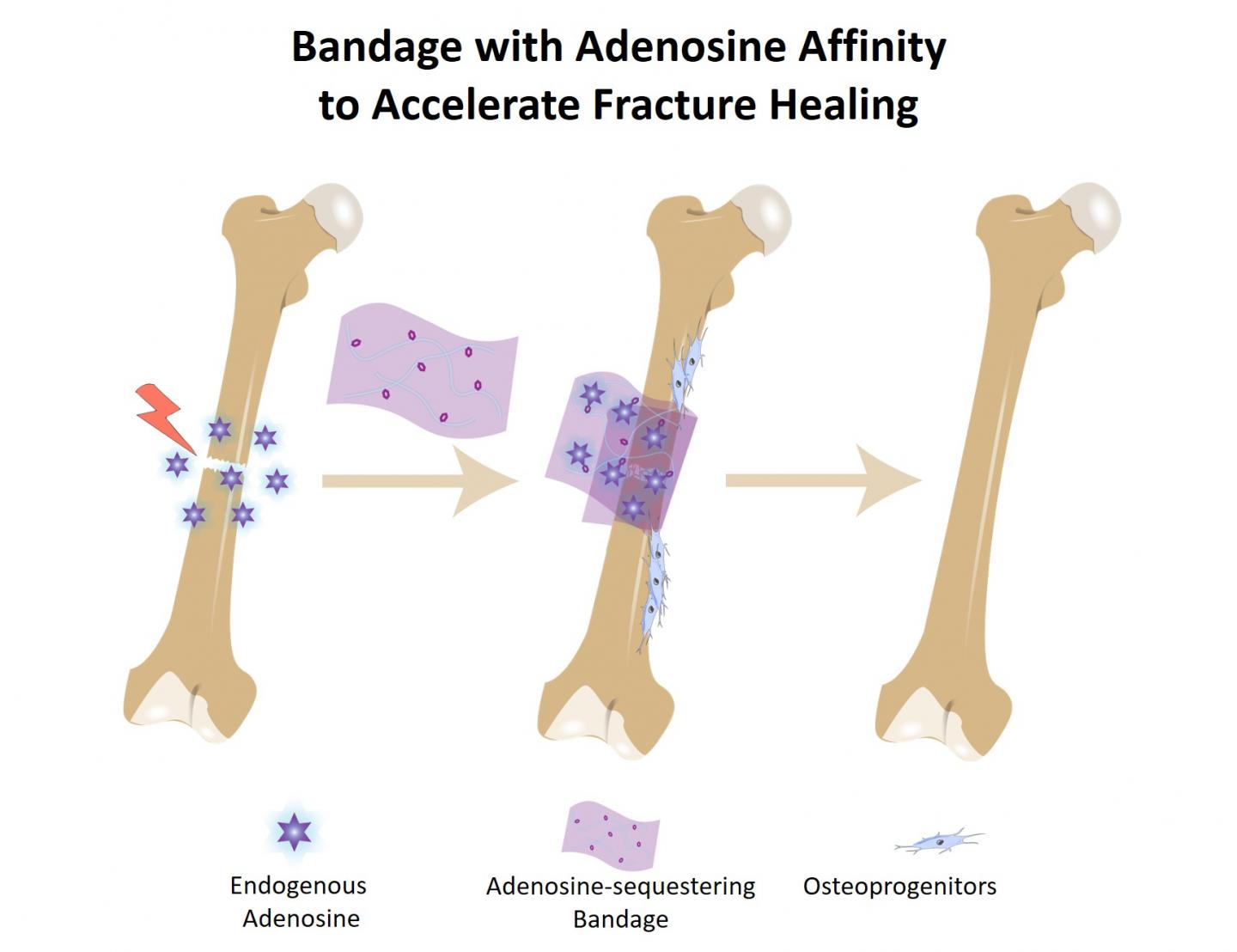 Bandage Graphic