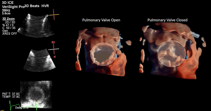 3D ICE Imaging