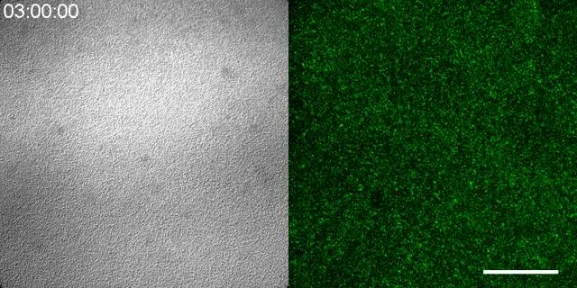 Video: Live Imaging of Cell-Cell Signaling during Aggregation of <I>Dictyostelium</i> Cells