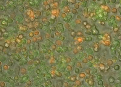 Cancer Cells