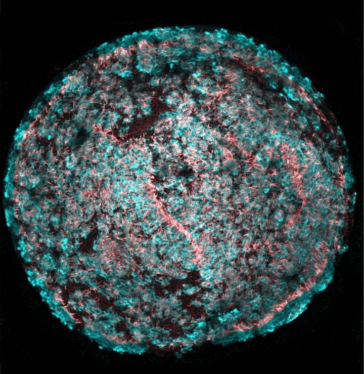 Hair Cell Regeneration