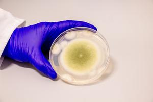 Aspergillus Flavus, Toxic Tomb Fungus Turned Cancer Killer