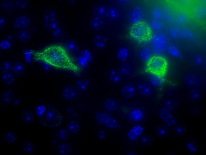 PNN Micrograph