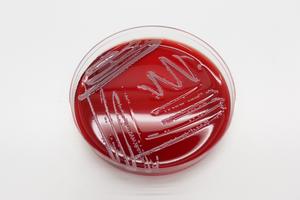 Staphylococcus borealis