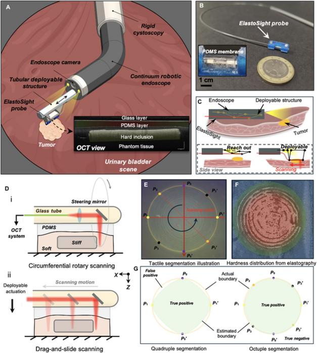 Working principle of bimodal tactile tomography for intracavitary microstructure profiling and segmentation.