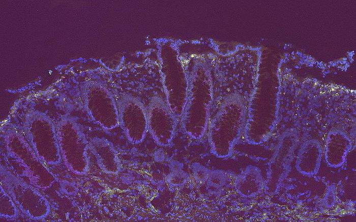 The intestinal mucosa with its characteristic invaginations, the intestinal crypts