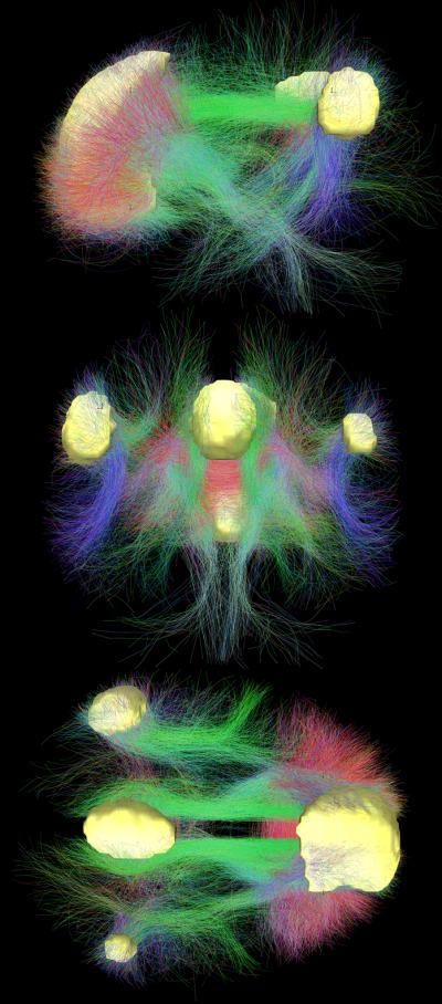 Brain Connectivity