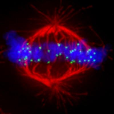 Micrograph of a Cell in Metaphase
