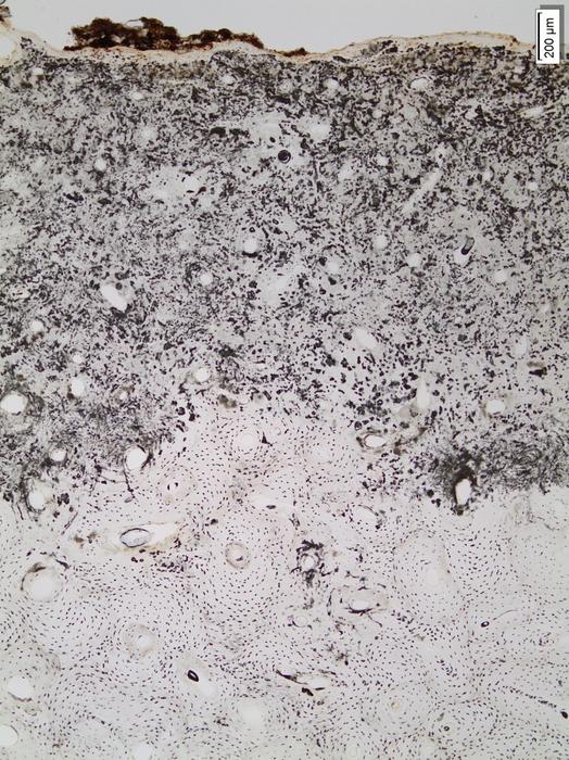 Histological and metagenomic analysis of microbial communities in archaeological human bones
