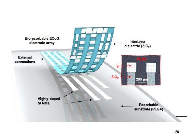 Next-Gen Electrode