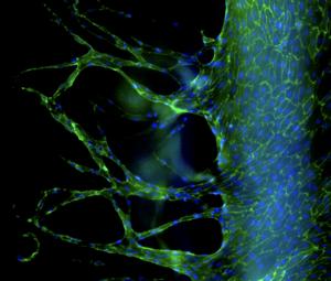 New blood vessels sprouting